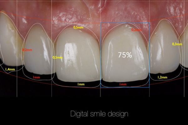 Digital smile academy