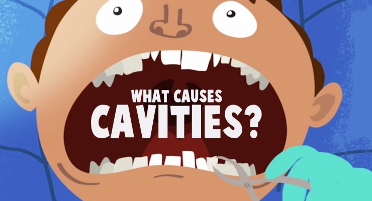 What causes cavities? 