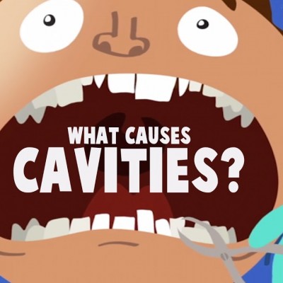 What causes cavities? 